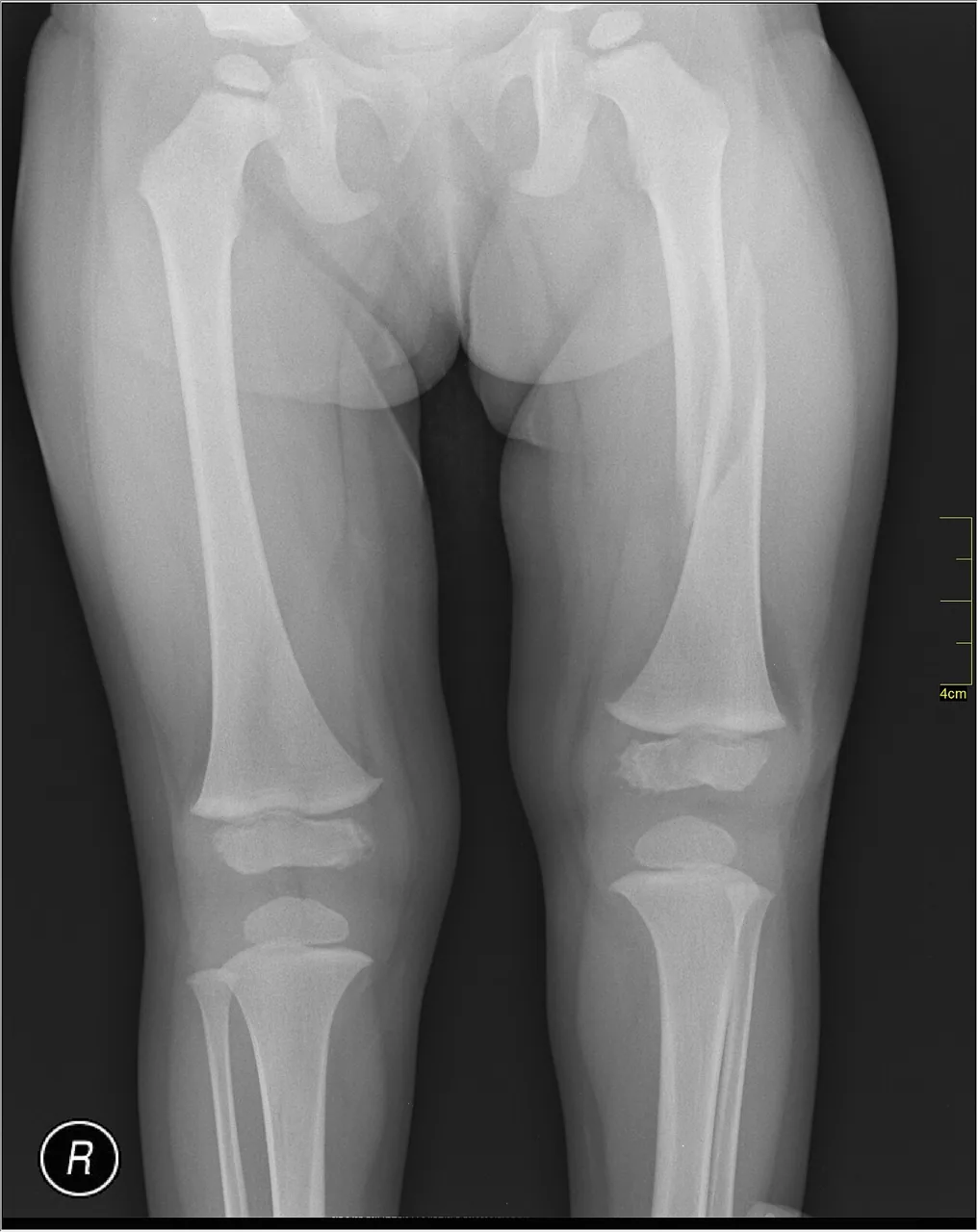 Lower limb radiograph for self-assessment