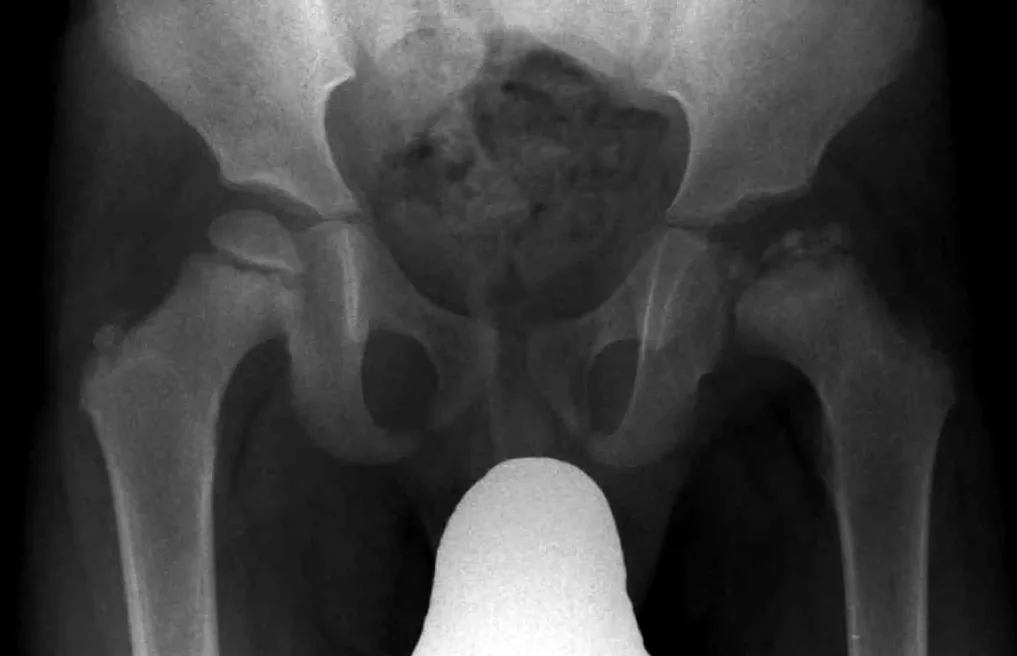 Paediatric radiograph for self-assessment