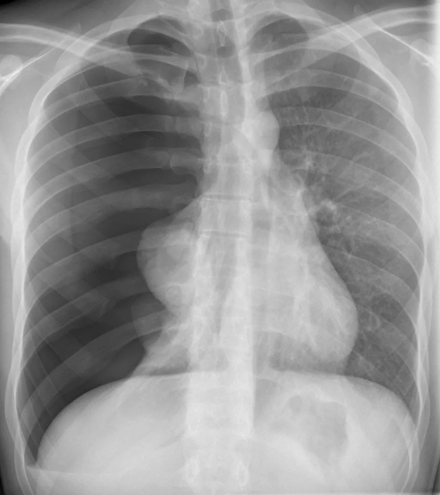 Chest radiograph for self-assessment