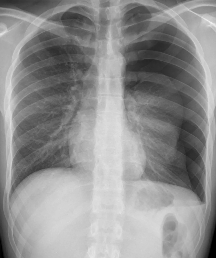 Chest radiograph for self-assessment