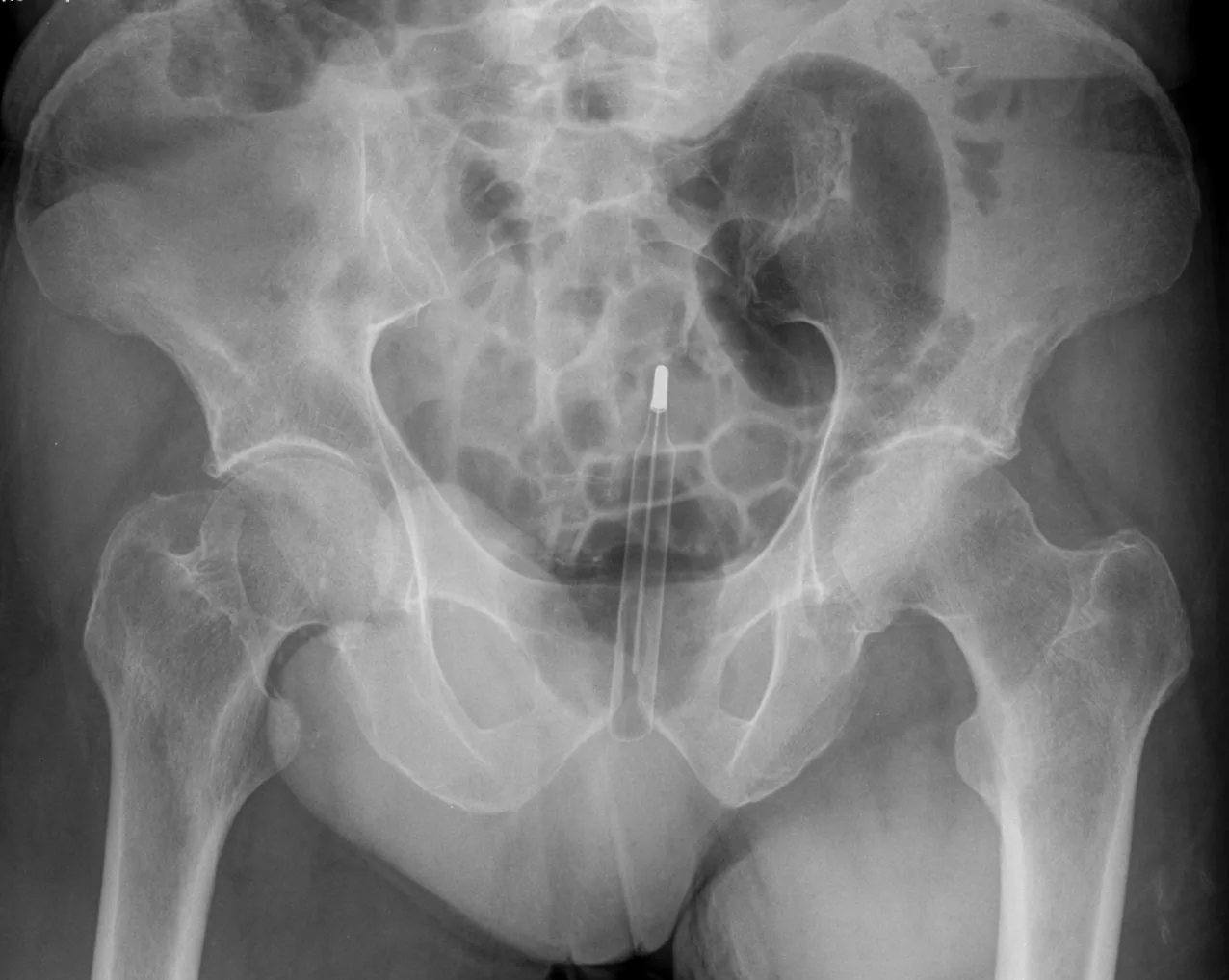 Abdomen radiograph for self-assessment