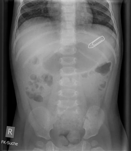 Abdomen radiograph for self-assessment