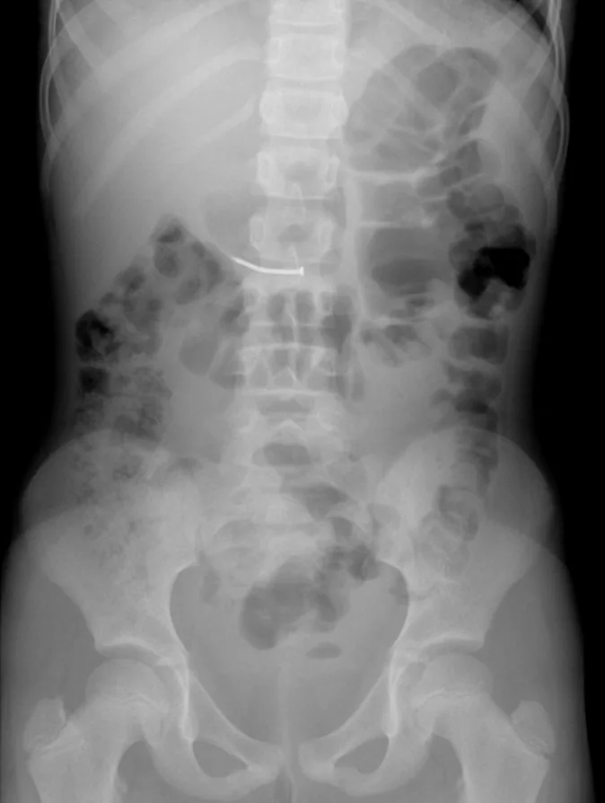Abdomen radiograph for self-assessment