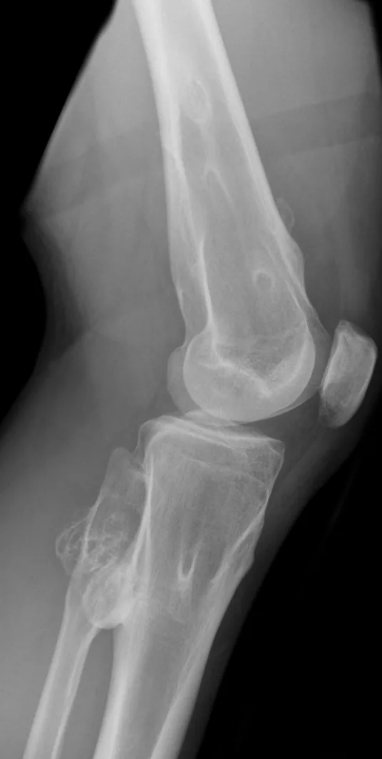 Bone & joint disease radiograph for self-assessment