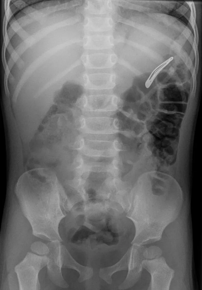 Abdomen radiograph for self-assessment