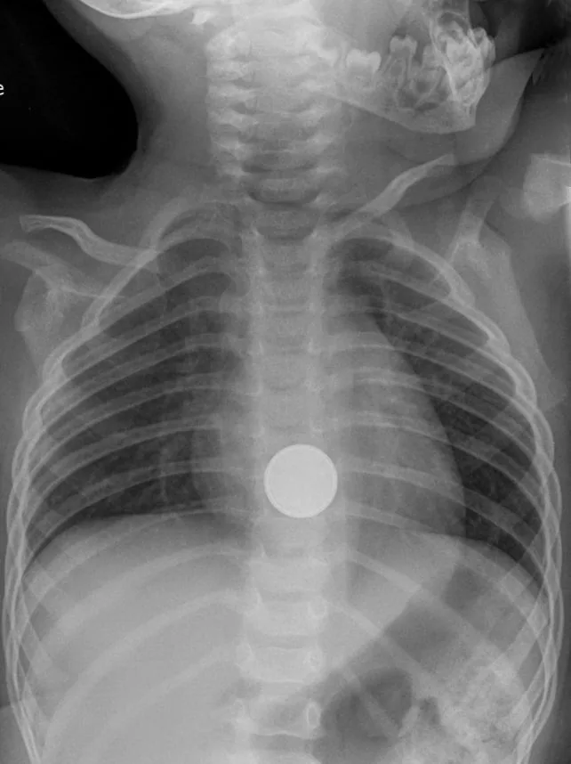 Paediatric radiograph for self-assessment