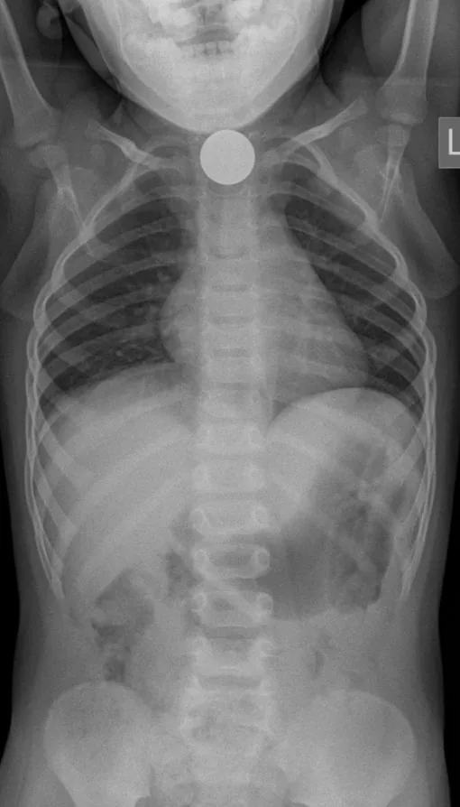 Paediatric radiograph for self-assessment