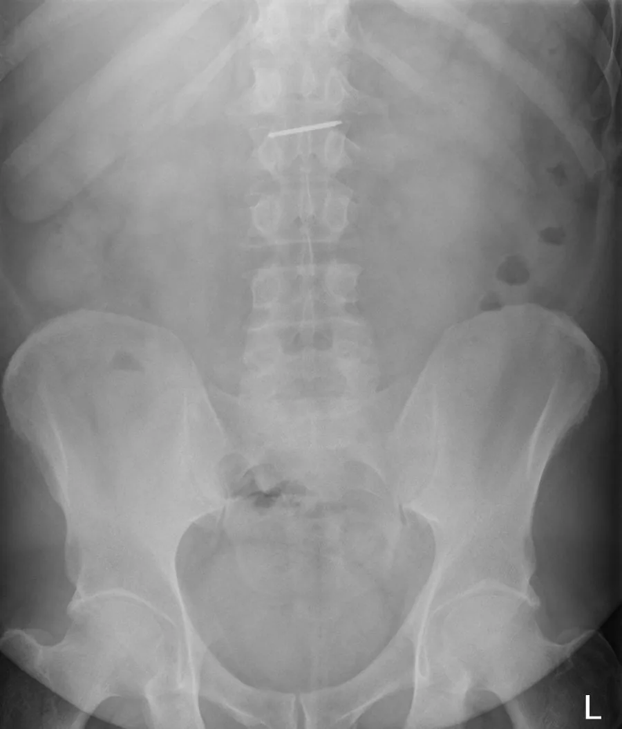 Abdomen radiograph for self-assessment