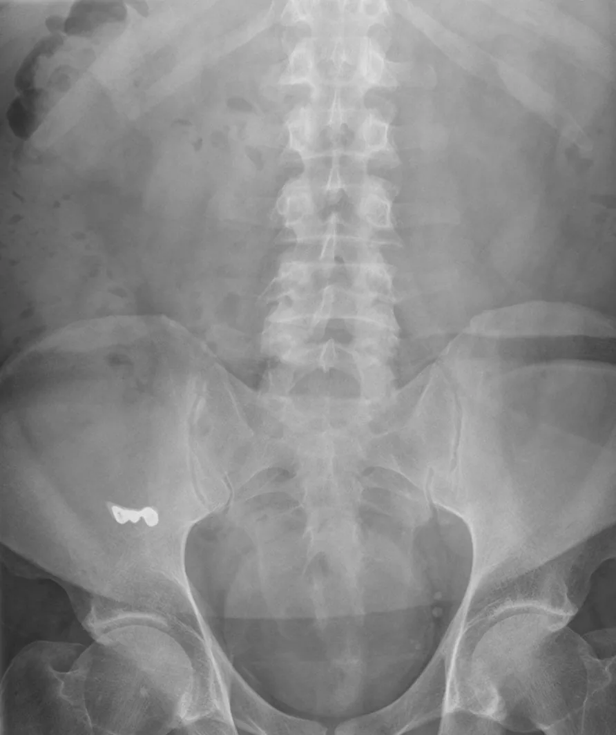Abdomen radiograph for self-assessment