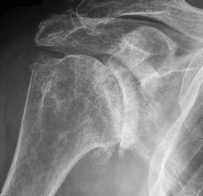 Bone & joint disease radiograph for self-assessment