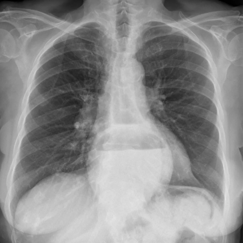 Chest radiograph for self-assessment