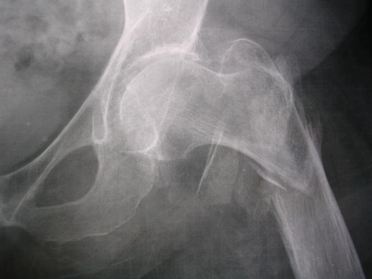 Lower limb radiograph for self-assessment