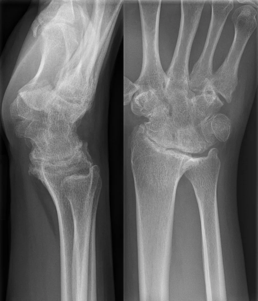 Bone & joint disease radiograph for self-assessment