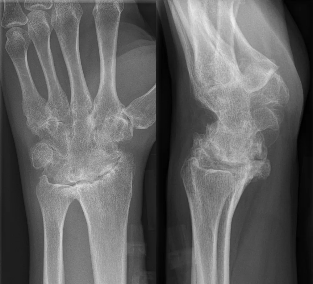 Bone & joint disease radiograph for self-assessment