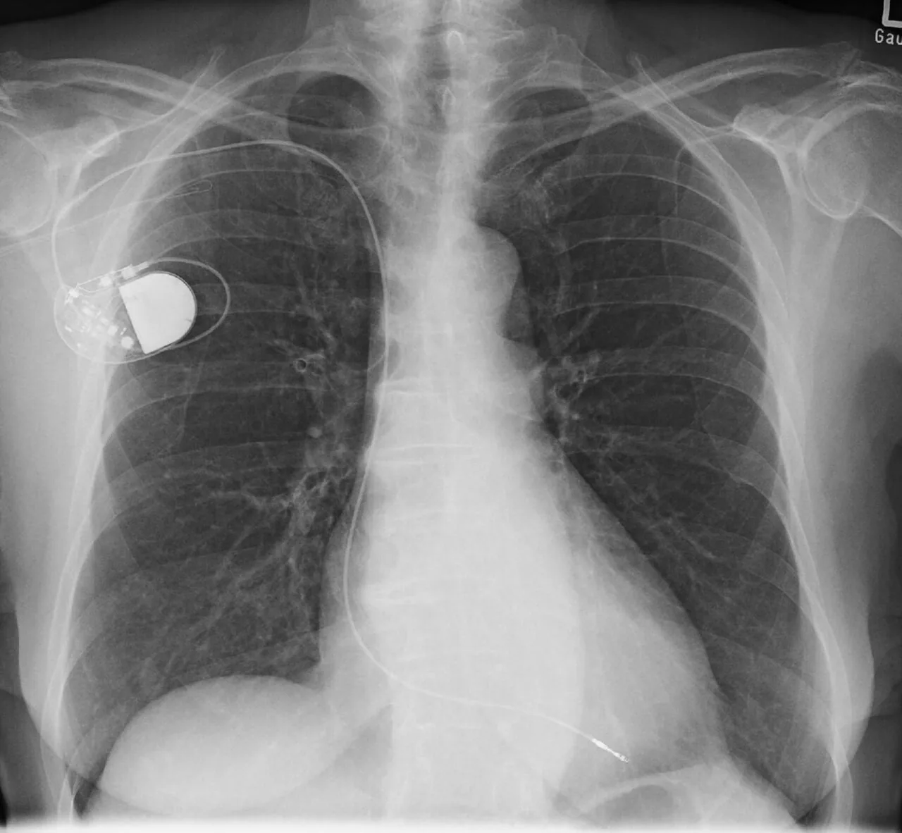 Lines & tubes radiograph for self-assessment