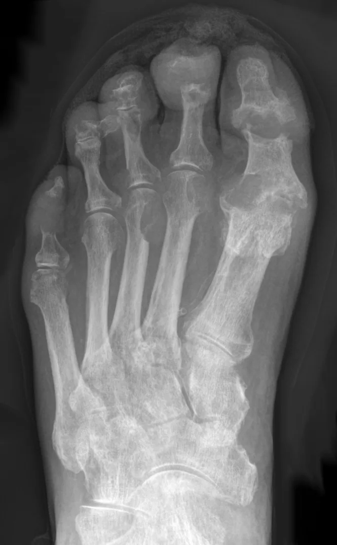Bone & joint disease radiograph for self-assessment
