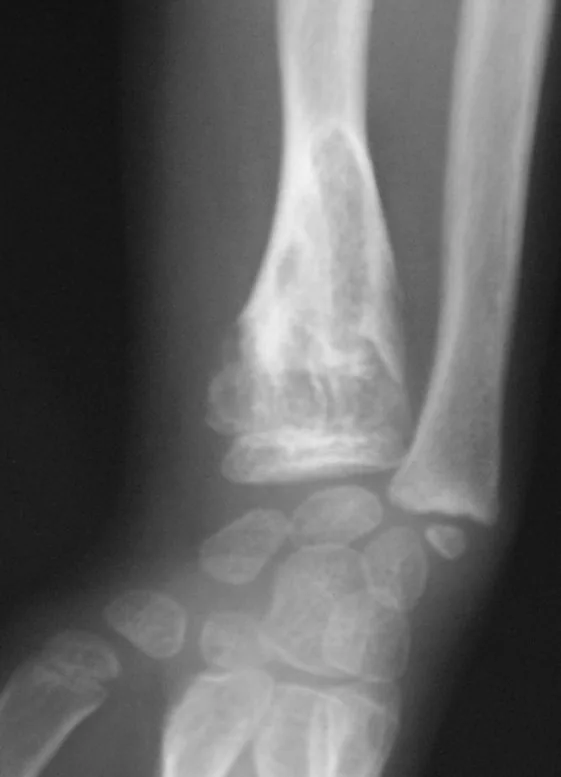 Bone & joint disease radiograph for self-assessment