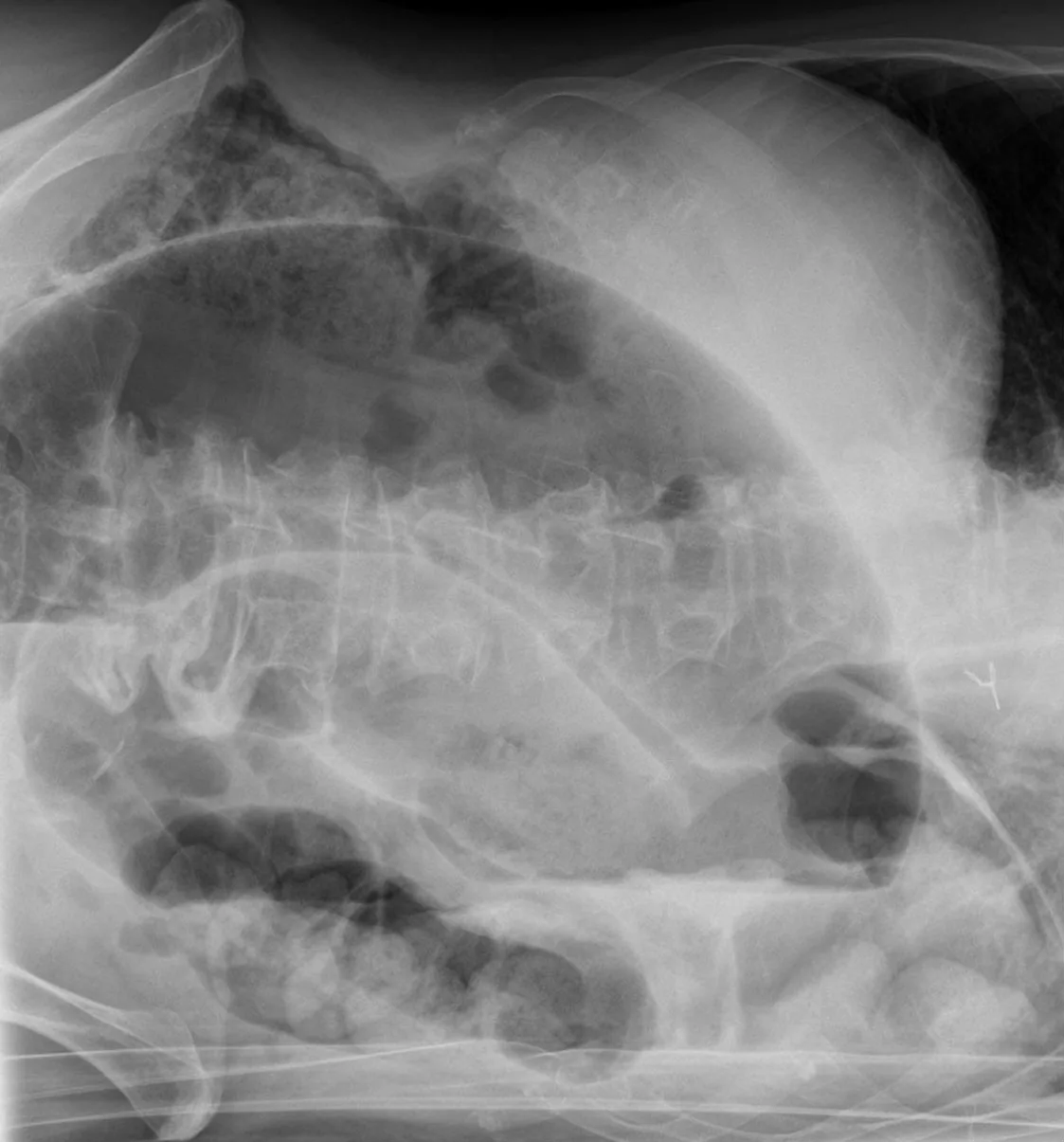 Abdomen radiograph for self-assessment