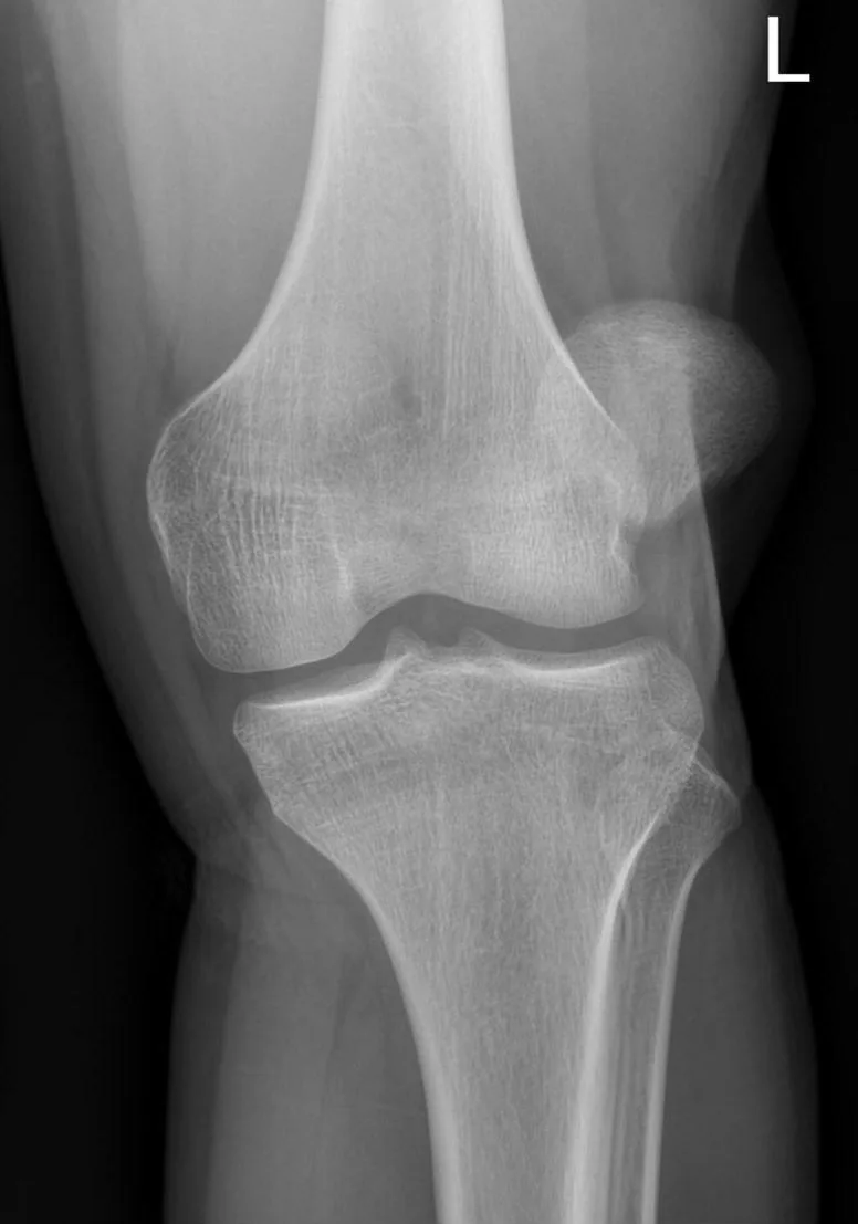 Lower limb radiograph for self-assessment