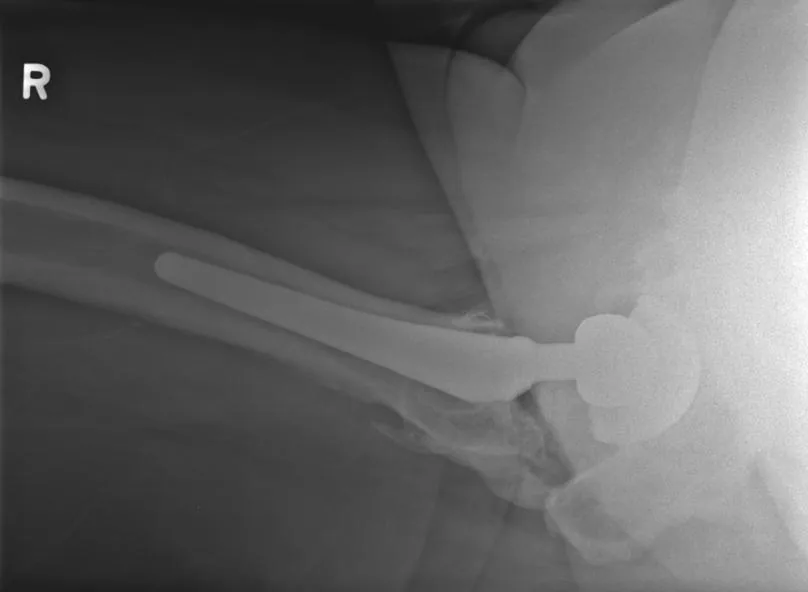 Bone & joint disease radiograph for self-assessment