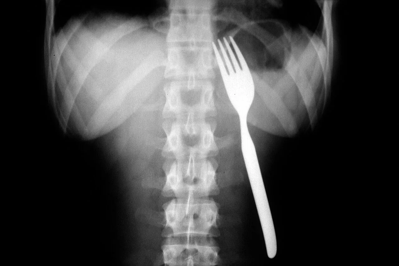 Abdomen radiograph for self-assessment