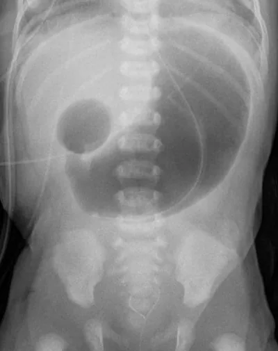 Paediatric radiograph for self-assessment