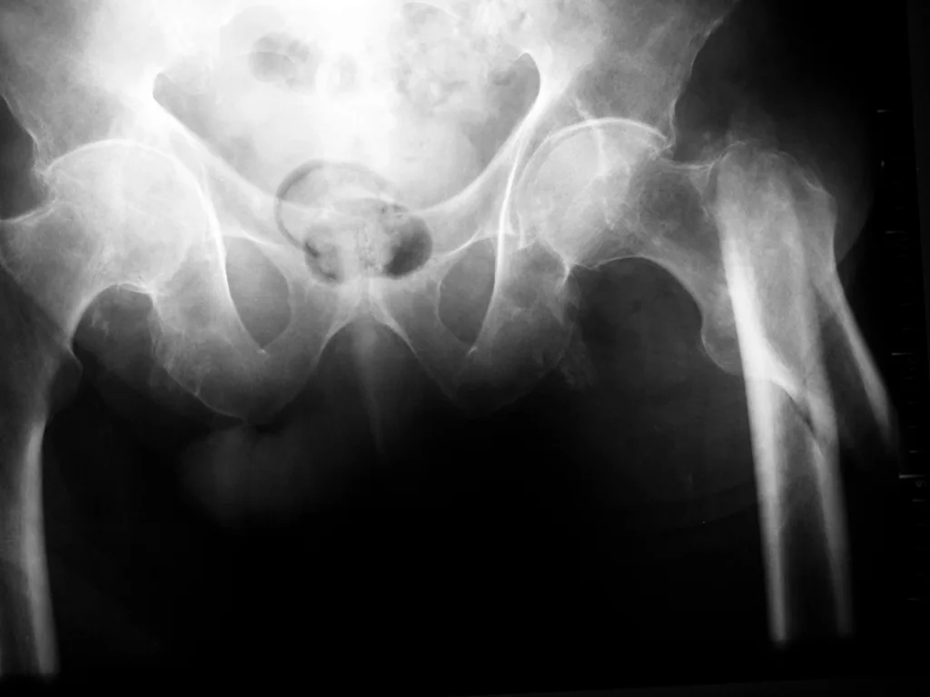 Lower limb radiograph for self-assessment