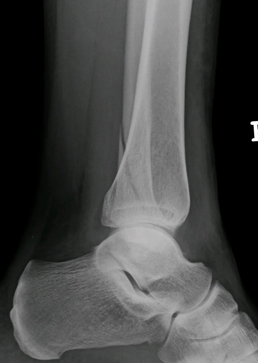 Lower limb radiograph for self-assessment