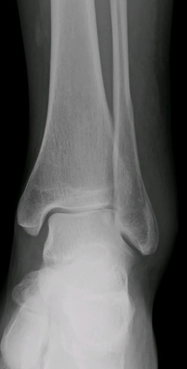 Lower limb radiograph for self-assessment