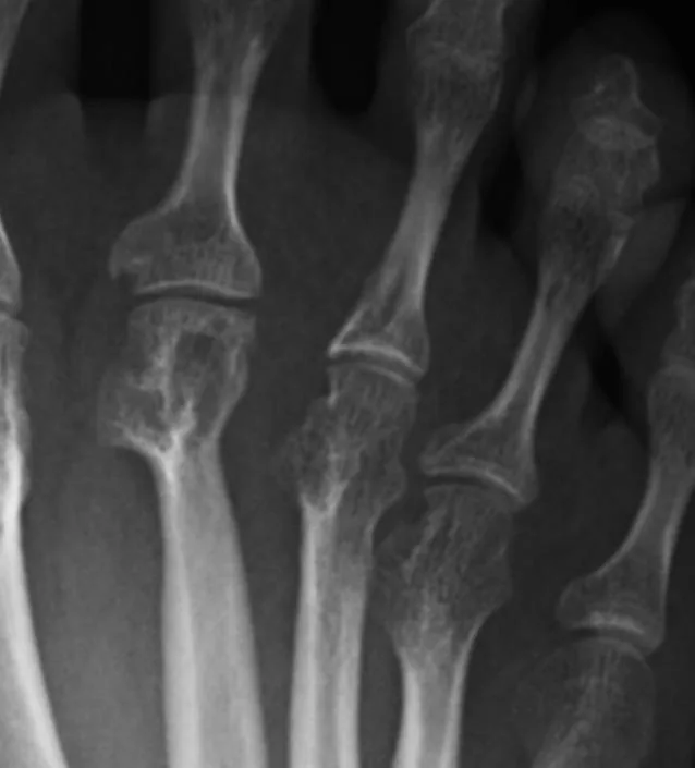 Bone & joint disease radiograph for self-assessment