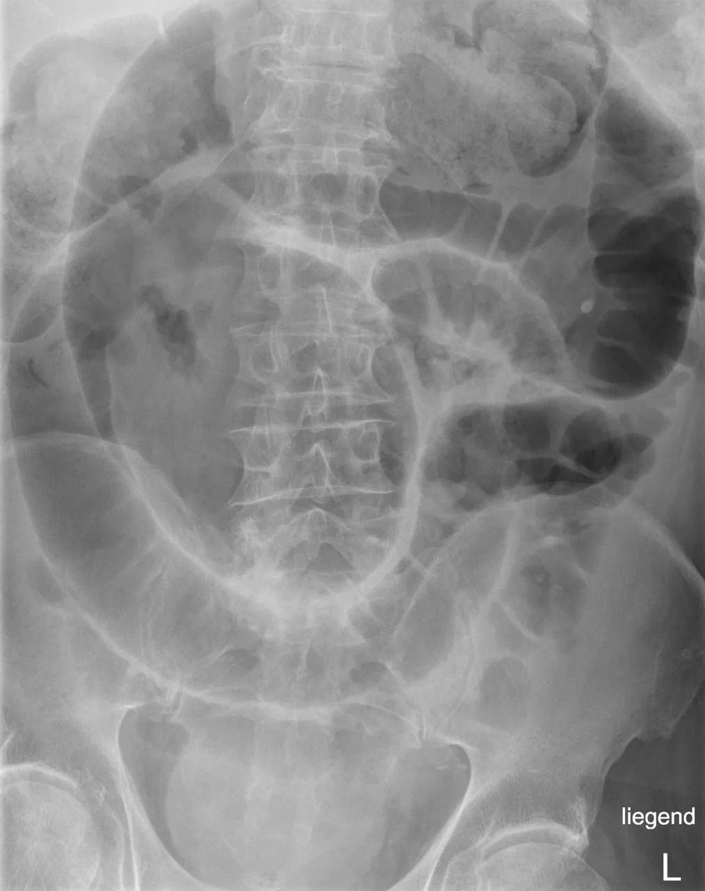 Abdomen radiograph for self-assessment