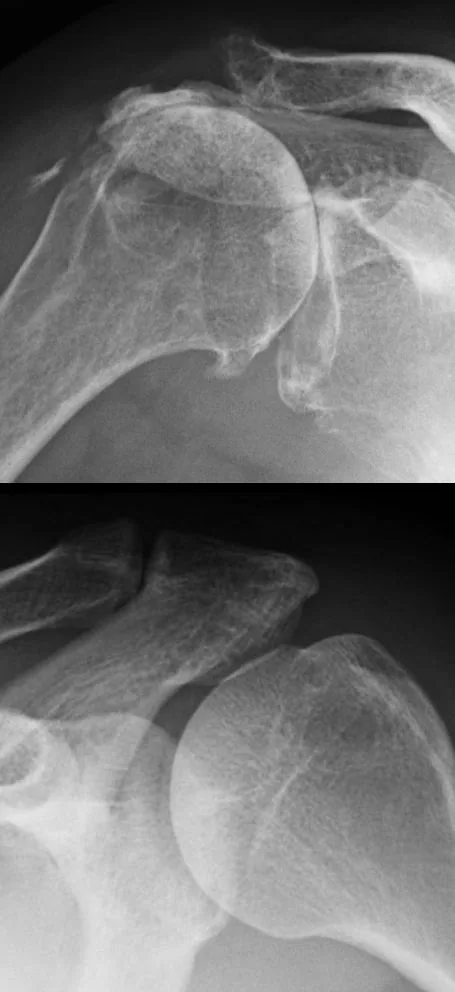 Bone & joint disease radiograph for self-assessment