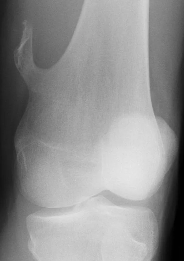 Bone & joint disease radiograph for self-assessment