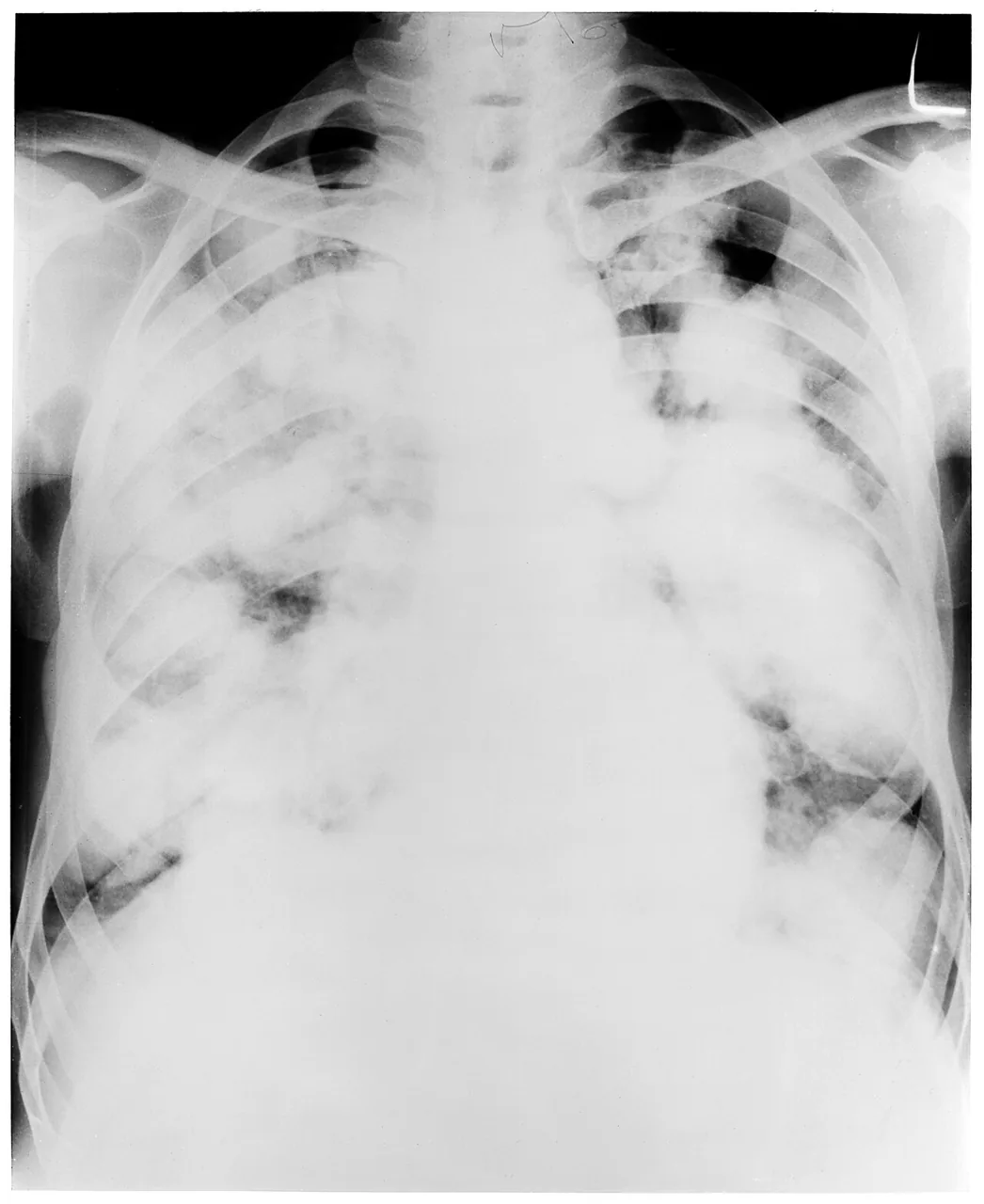 Chest radiograph for self-assessment