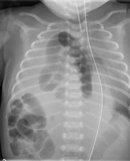 Chest radiograph for self-assessment