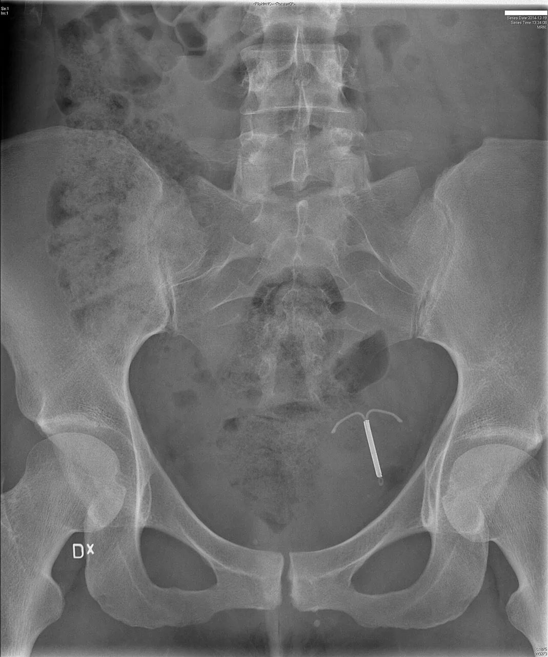 Abdomen radiograph for self-assessment