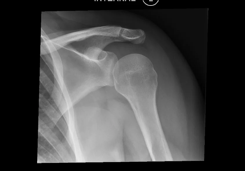 Upper limb radiograph for self-assessment