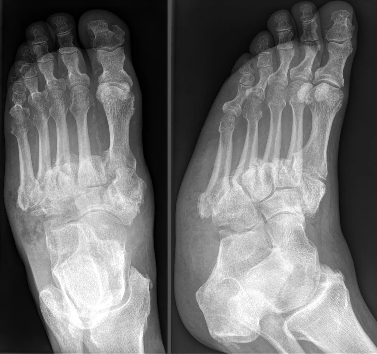 Bone & joint disease radiograph for self-assessment
