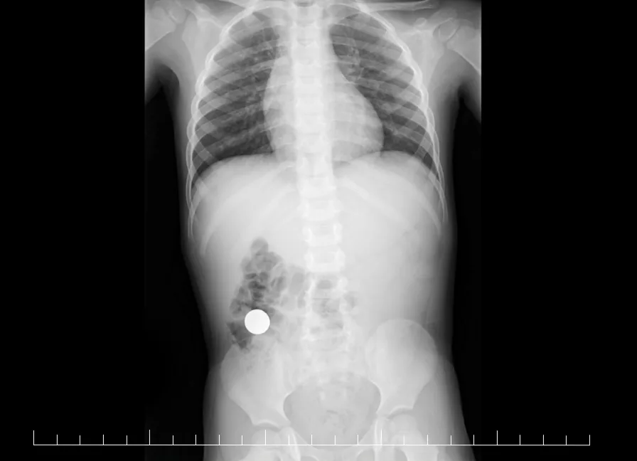 Abdomen radiograph for self-assessment