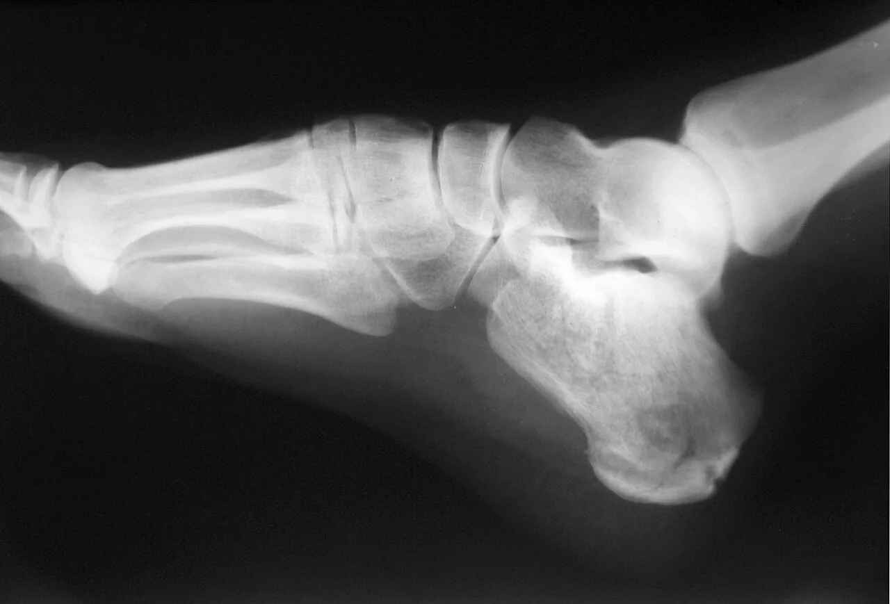 Lower limb radiograph for self-assessment
