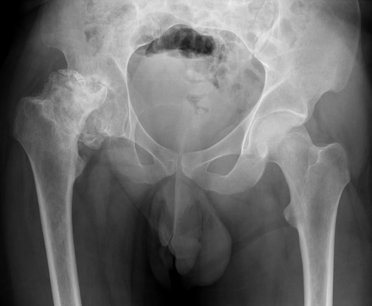 Bone & joint disease radiograph for self-assessment