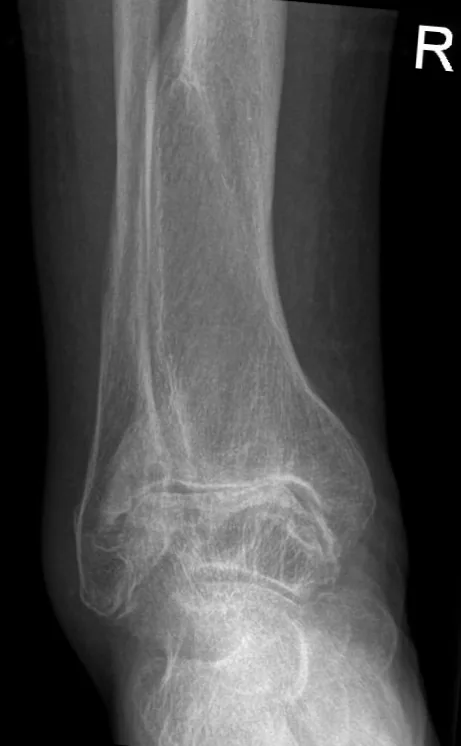 Bone & joint disease radiograph for self-assessment