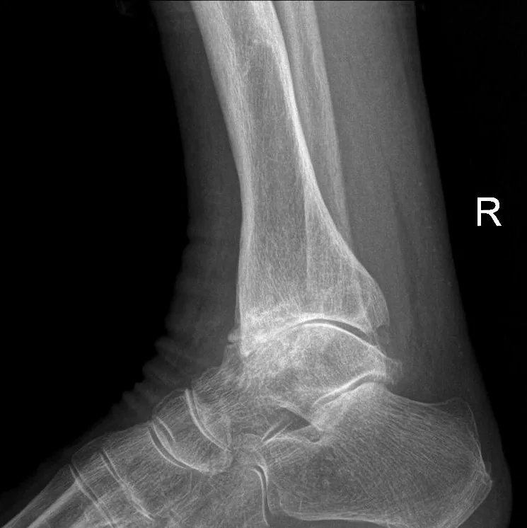 Bone & joint disease radiograph for self-assessment