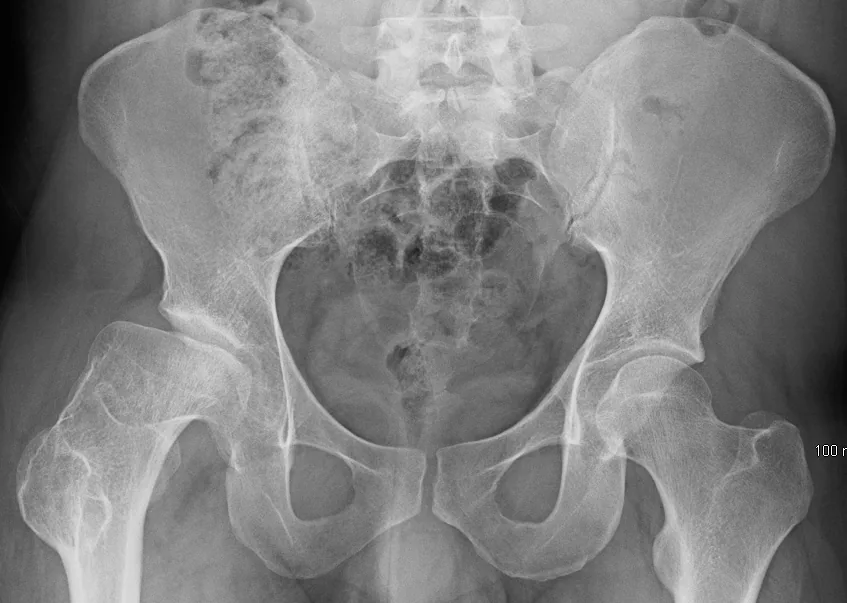 Paediatric radiograph for self-assessment