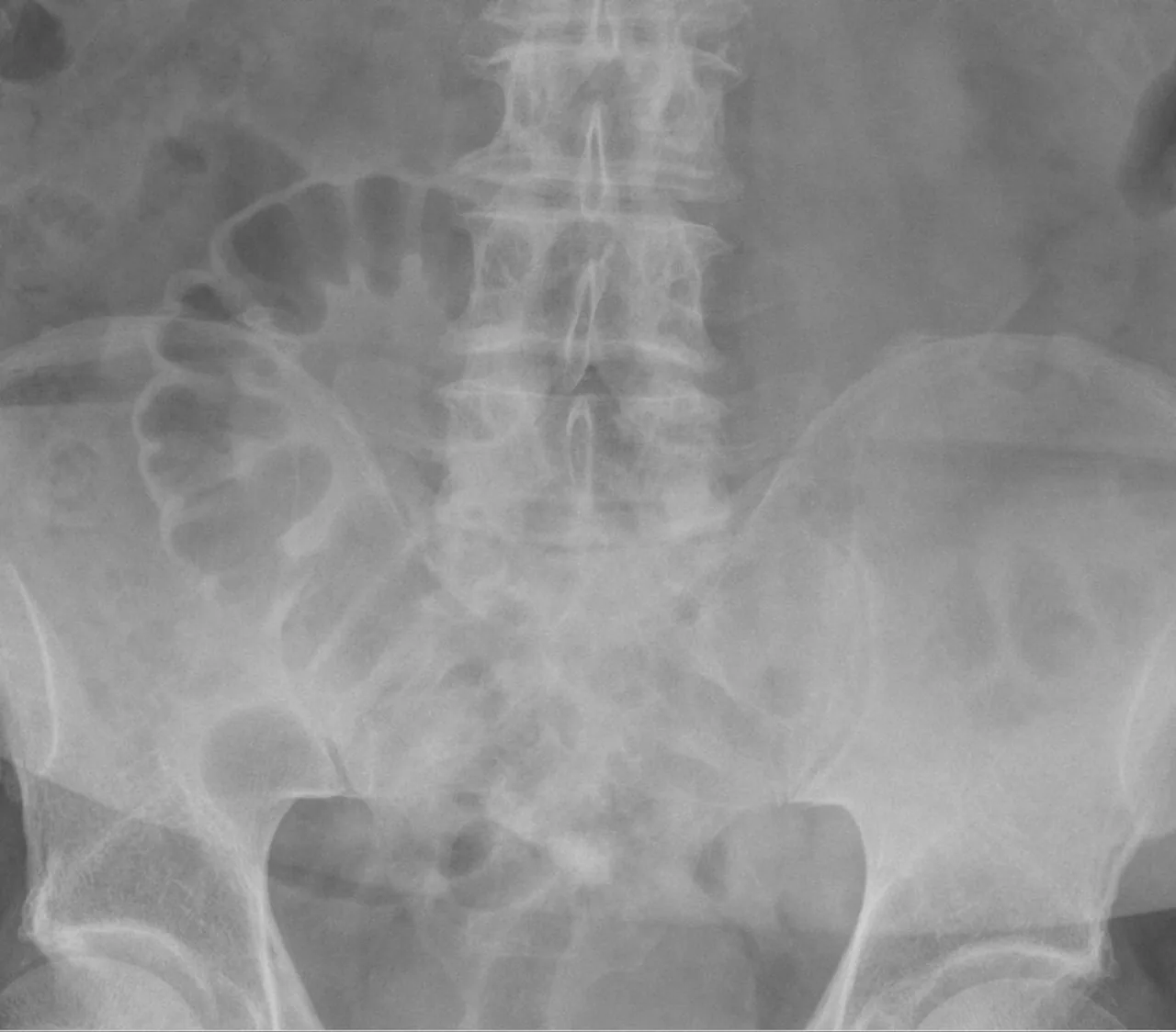Abdomen radiograph for self-assessment