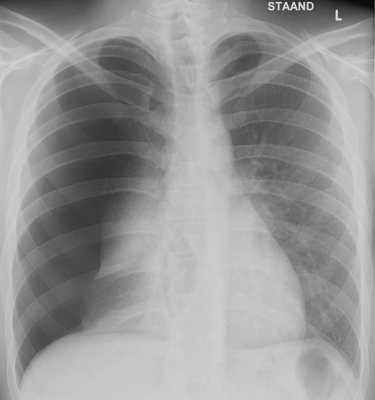 Chest radiograph for self-assessment