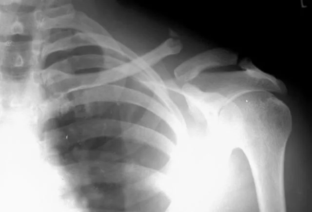 Upper limb radiograph for self-assessment
