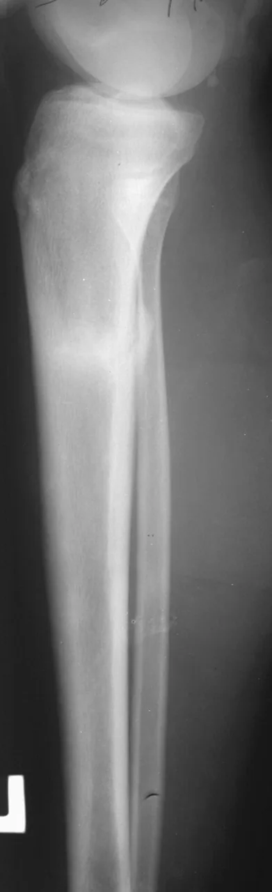 Lower limb radiograph for self-assessment