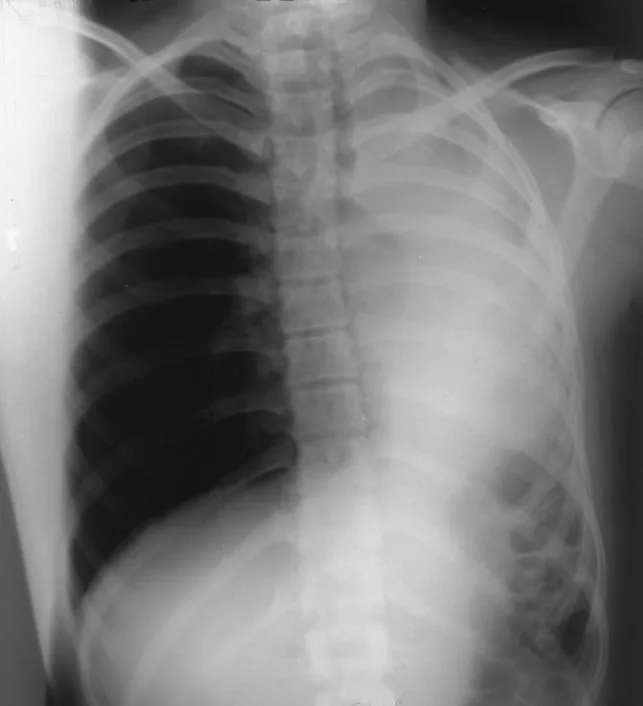 Chest radiograph for self-assessment