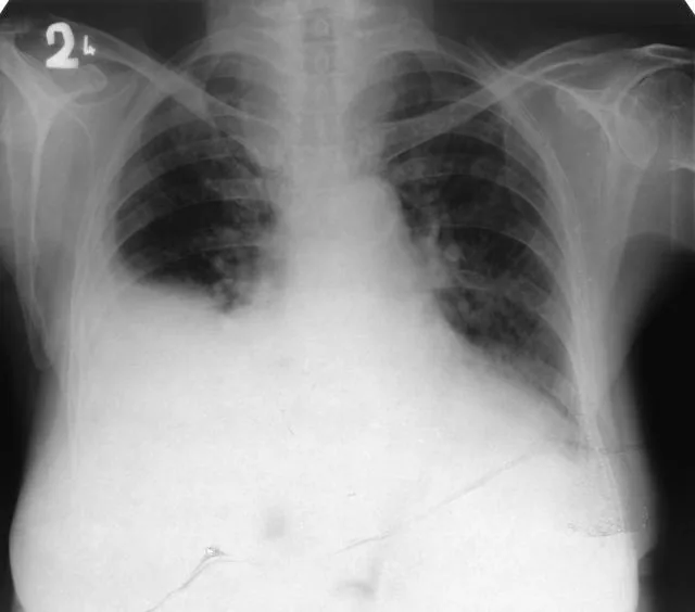 Chest radiograph for self-assessment